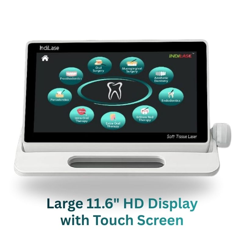 indiase-Advance-screen